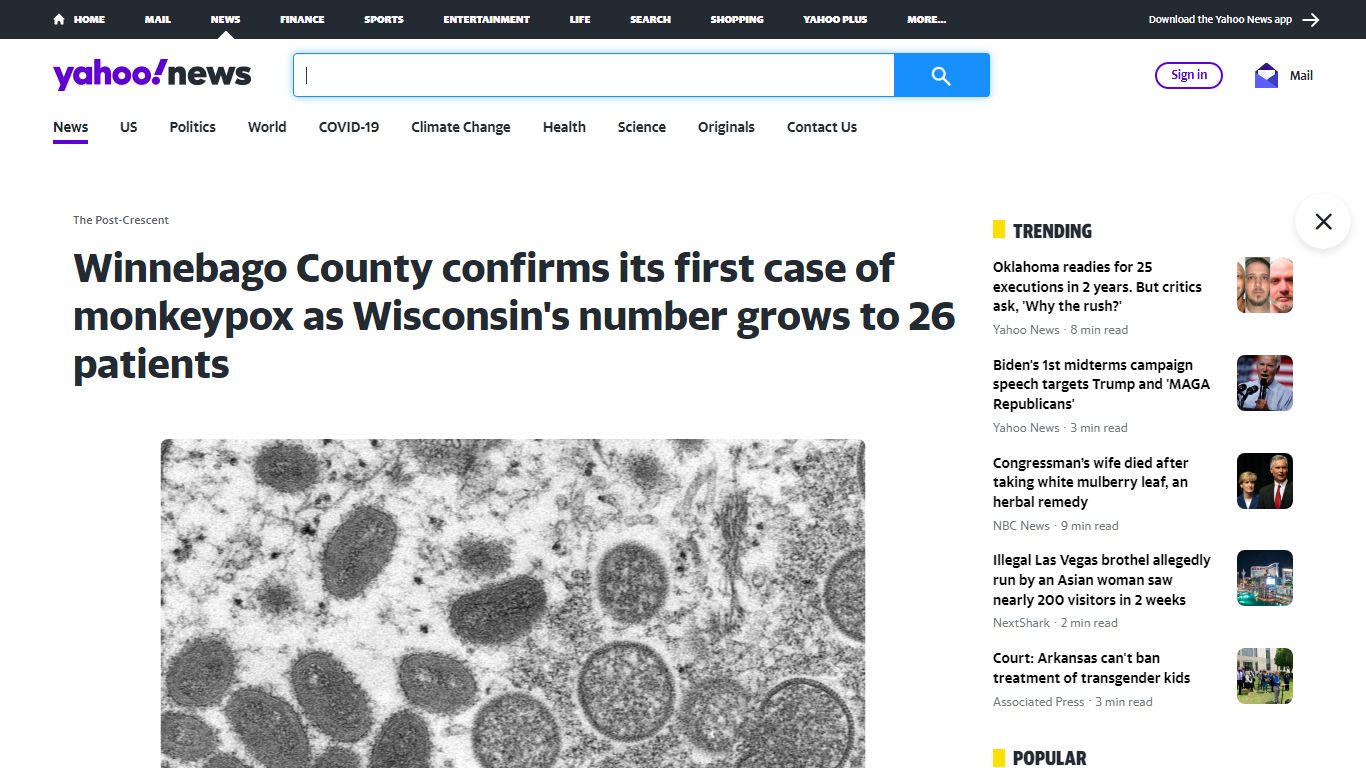 Winnebago County confirms its first case of monkeypox as Wisconsin's ...