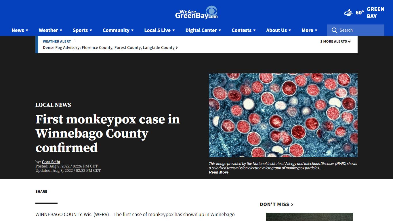 First monkeypox case in Winnebago County confirmed